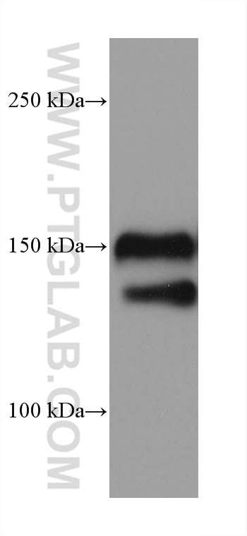Western Blot (WB) analysis of HeLa cells using EGFR Monoclonal antibody (66455-1-Ig)