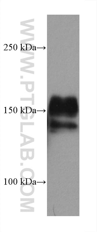 Western Blot (WB) analysis of A549 cells using EGFR Monoclonal antibody (66455-1-Ig)