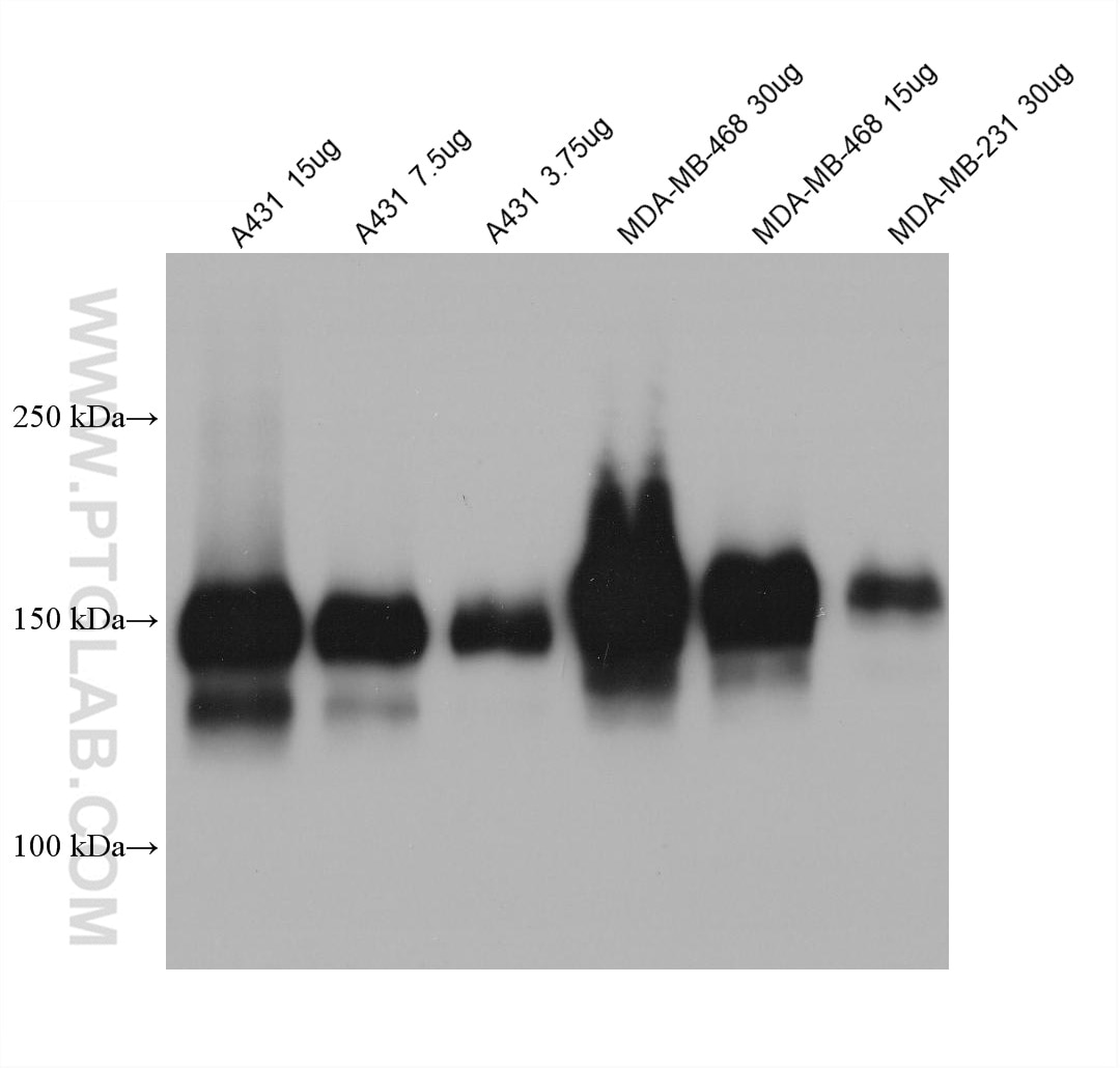 Western Blot (WB) analysis of various lysates using EGFR Monoclonal antibody (66455-1-Ig)
