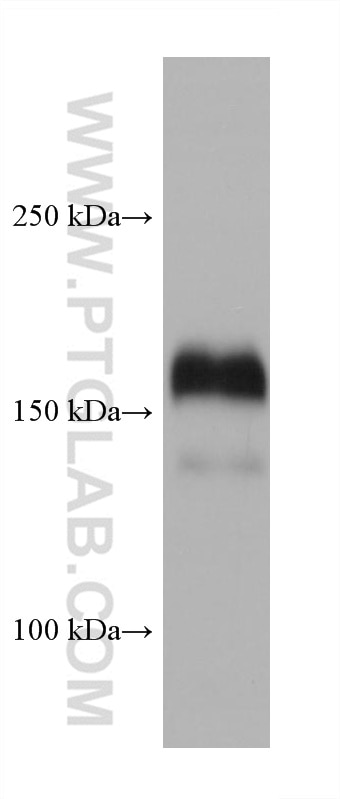 Western Blot (WB) analysis of EC109 cells using EGFR Monoclonal antibody (66455-1-Ig)