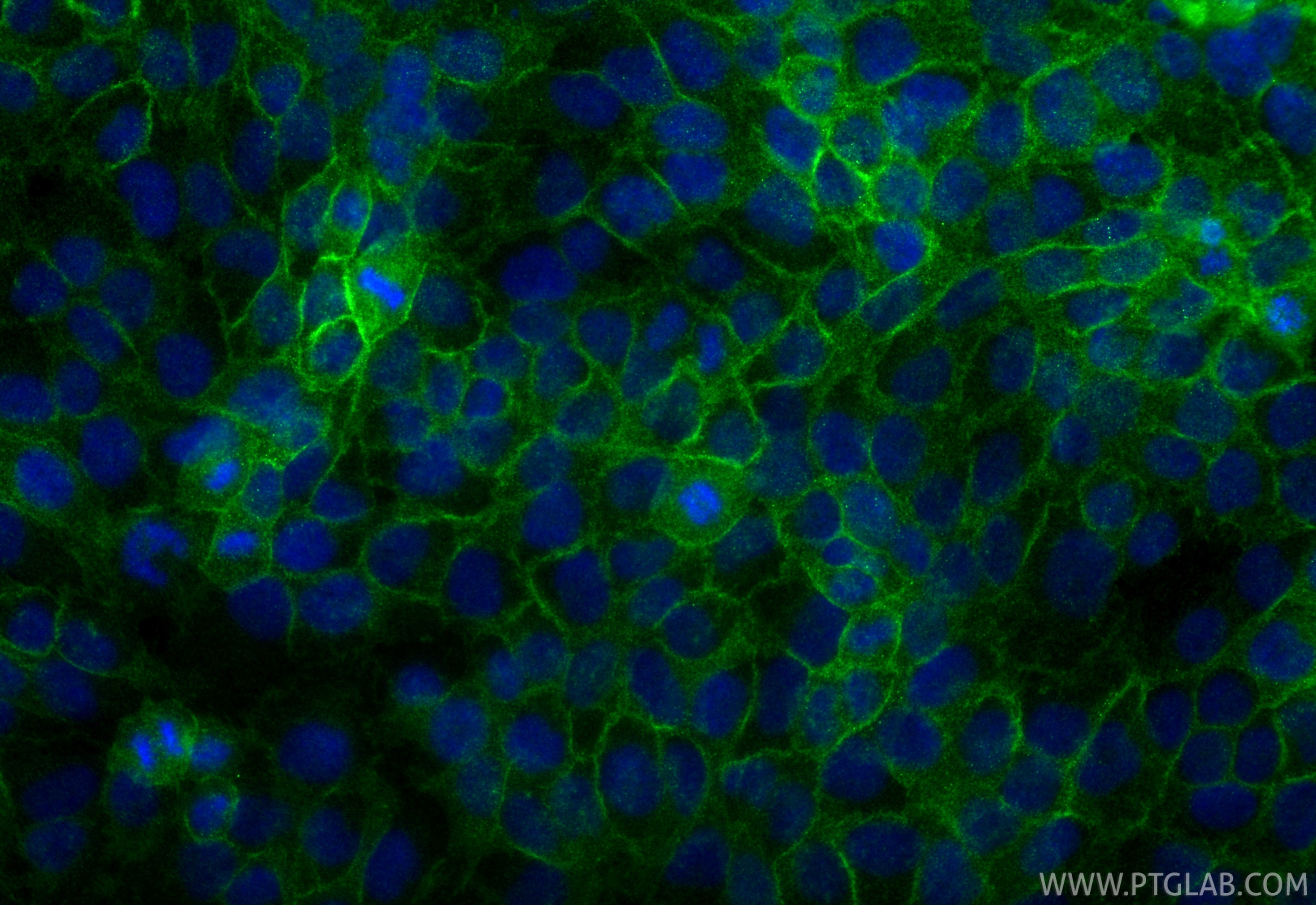Immunofluorescent analysis of (4% PFA) fixed HaCaT cells using EGFR antibody (83806-1-RR, Clone: 240603F10 ) at dilution of 1:400 and CoraLite®488-Conjugated Goat Anti-Rabbit IgG(H+L) (SA00013-2). Immunofluorescence (IF) / fluorescent staining of HaCaT cells using EGFR Recombinant monoclonal antibody (83806-1-RR)