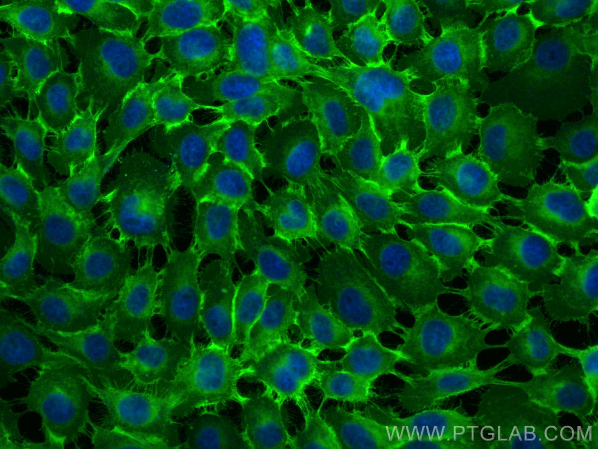 Immunofluorescence (IF) / fluorescent staining of A431 cells using CoraLite® Plus 488-conjugated EGFR Polyclonal anti (CL488-30139)