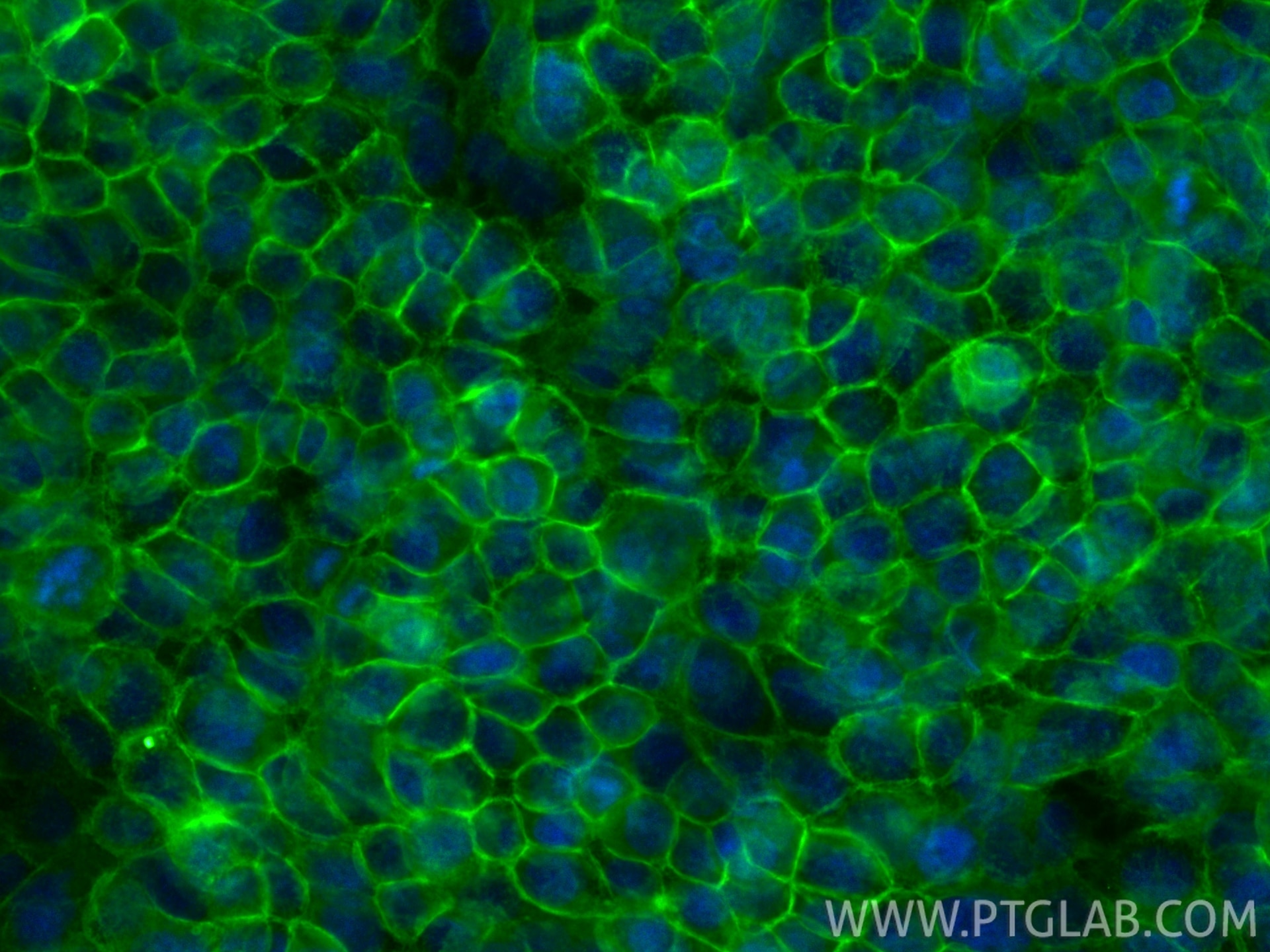 Immunofluorescence (IF) / fluorescent staining of A431 cells using CoraLite® Plus 488-conjugated EGFR Recombinant ant (CL488-83806)