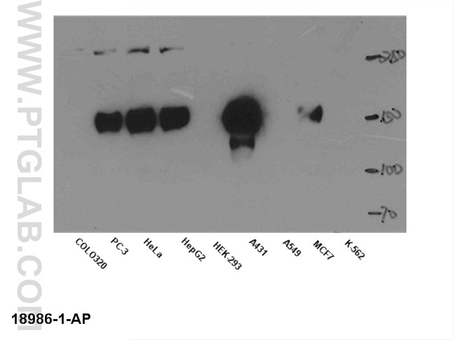 WB analysis of multi-cells using 18986-1-AP