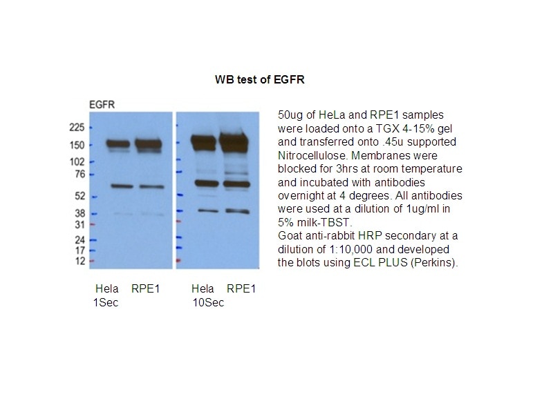 WB analysis of HeLa/RPE1 cells using 18986-1-AP
