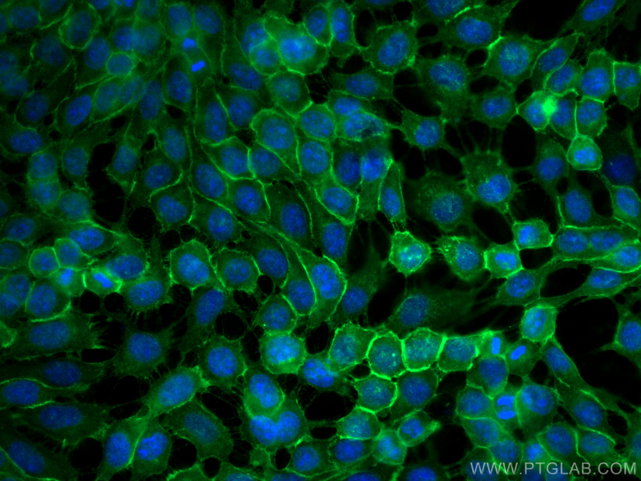 Immunofluorescence (IF) / fluorescent staining of A431 cells using EGFR-Specific Polyclonal antibody (18986-1-AP)