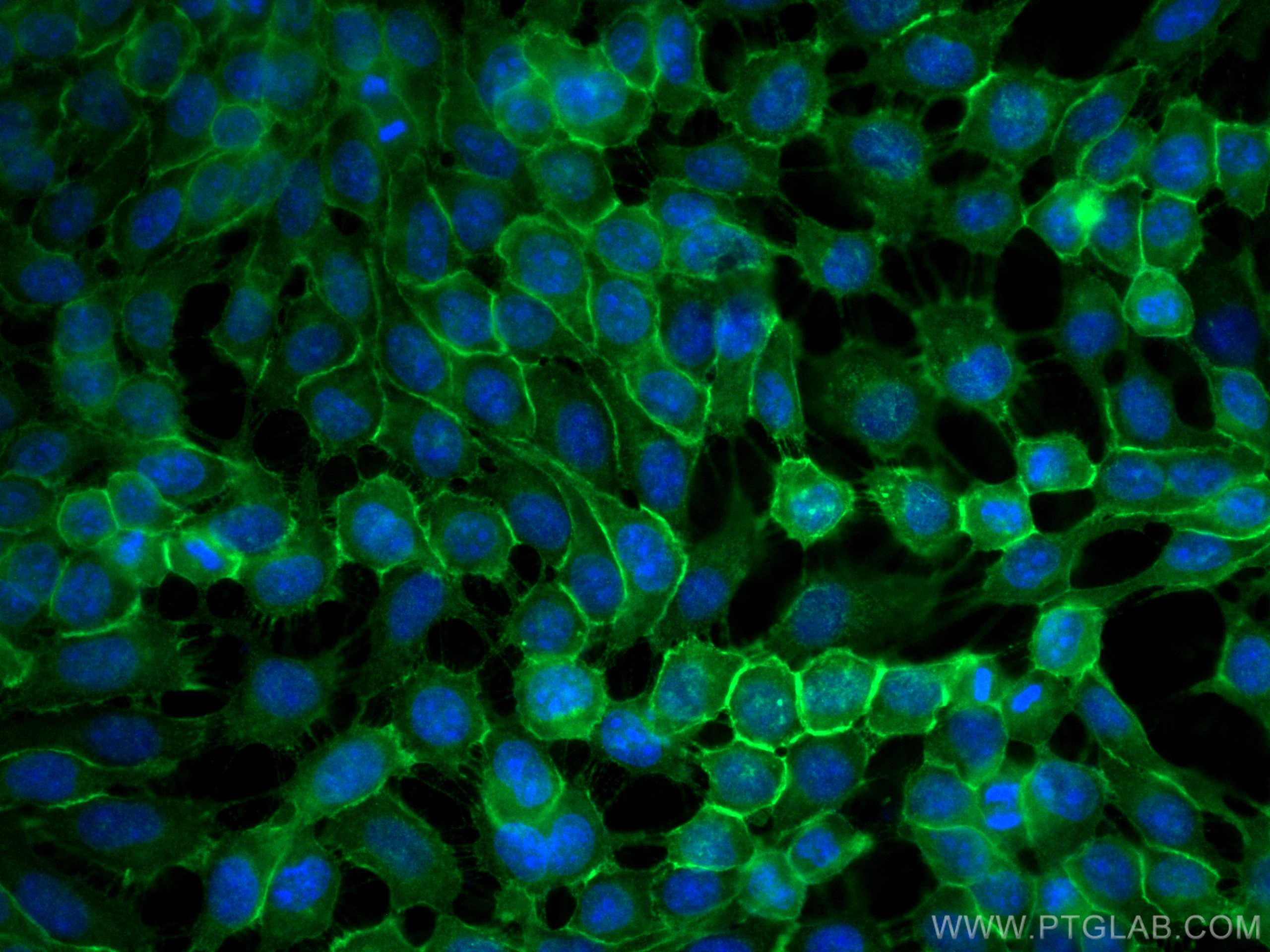 IF Staining of A431 using 18986-1-AP