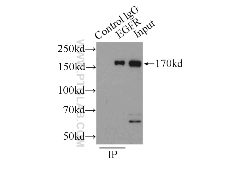 Immunoprecipitation (IP) experiment of MCF-7 cells using EGFR-Specific Polyclonal antibody (18986-1-AP)