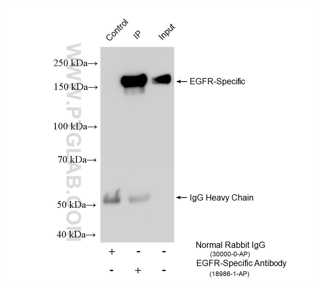 Immunoprecipitation (IP) experiment of L02 cells using EGFR-Specific Polyclonal antibody (18986-1-AP)