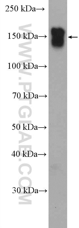 Western Blot (WB) analysis of L02 cells using EGFR-Specific Polyclonal antibody (18986-1-AP)