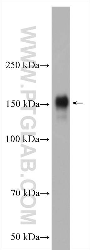Western Blot (WB) analysis of NCI-H1299 cells using EGFR-Specific Polyclonal antibody (18986-1-AP)