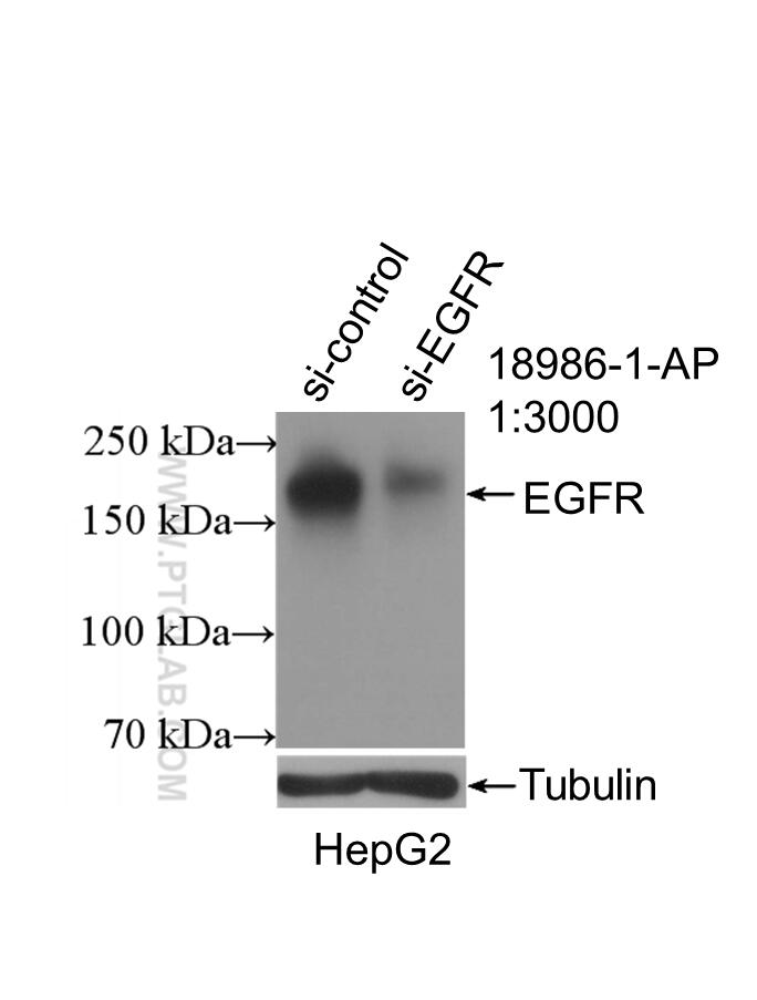 Western Blot (WB) analysis of HepG2 cells using EGFR-Specific Polyclonal antibody (18986-1-AP)