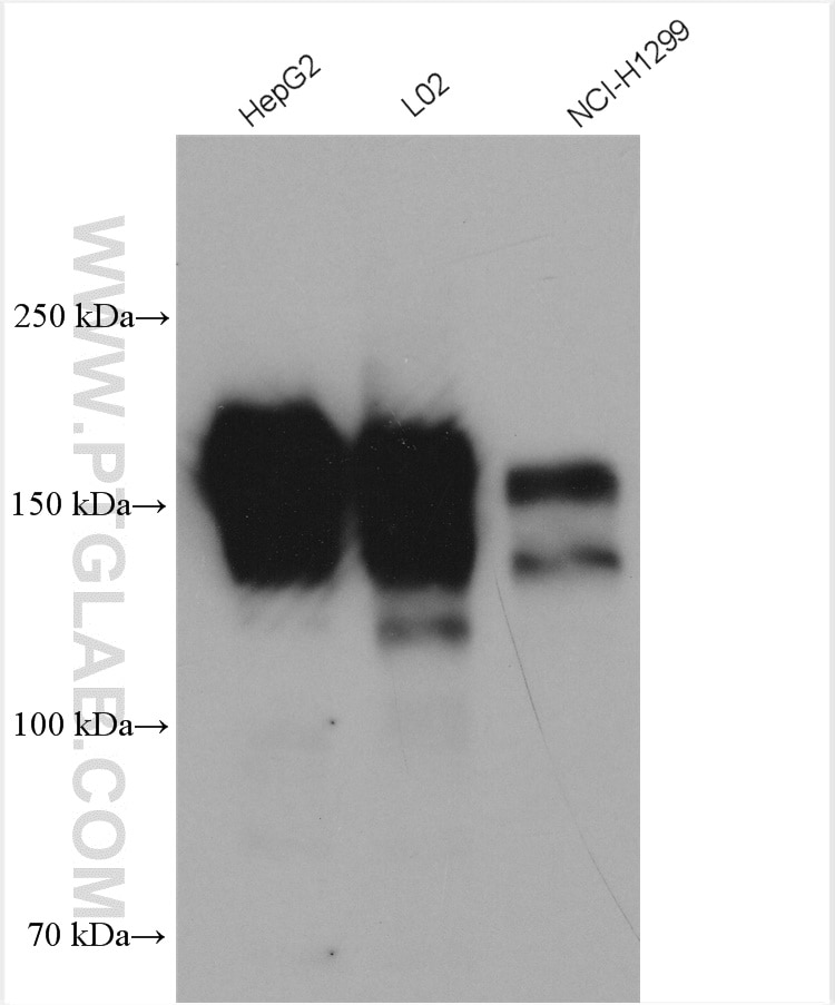 Western Blot (WB) analysis of various lysates using EGFR-Specific Polyclonal antibody (18986-1-AP)