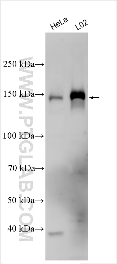 Western Blot (WB) analysis of various lysates using EGFR-Specific Polyclonal antibody (18986-1-AP)