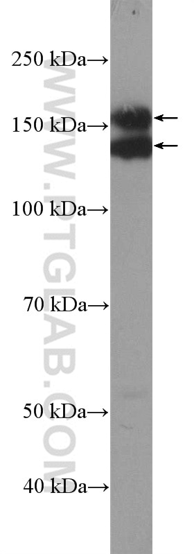 Western Blot (WB) analysis of A431 cells using EGFR-Specific Polyclonal antibody (18986-1-AP)