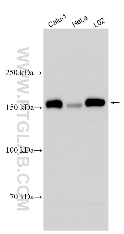Western Blot (WB) analysis of various lysates using EGFR-Specific Polyclonal antibody (18986-1-AP)