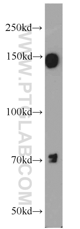 Western Blot (WB) analysis of HeLa cells using EGFR-Specific Polyclonal antibody (18986-1-AP)