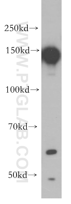 Western Blot (WB) analysis of MCF-7 cells using EGFR-Specific Polyclonal antibody (18986-1-AP)
