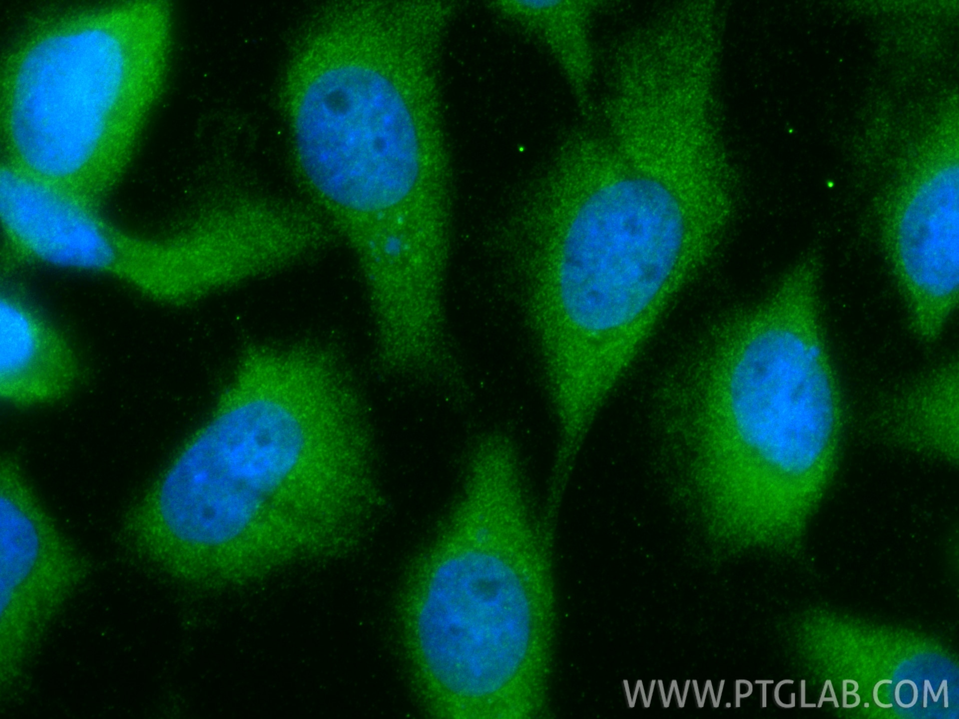 Immunofluorescent analysis of (-20°C Methanol) fixed A431 cells using PHD2/EGLN1 antibody (19886-1-AP) at dilution of 1:400 and CoraLite®488-Conjugated Goat Anti-Rabbit IgG(H+L) (SA00013-2). Immunofluorescence (IF) / fluorescent staining of A431 cells using PHD2/EGLN1 Polyclonal antibody (19886-1-AP)