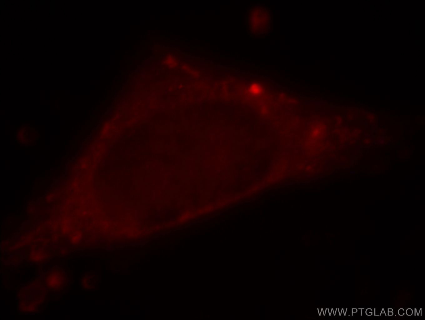 PHD2/EGLN1