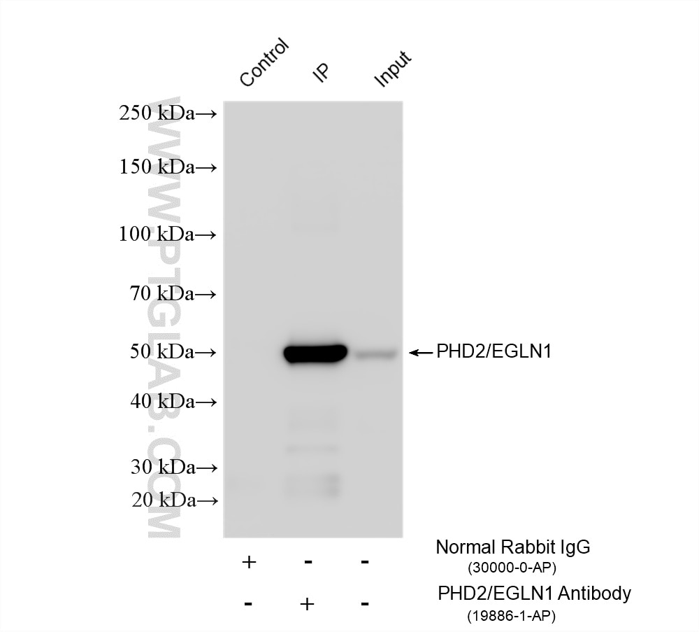 IP experiment of HEK-293 using 19886-1-AP Immunoprecipitation (IP) experiment of HEK-293 cells using PHD2/EGLN1 Polyclonal antibody (19886-1-AP)