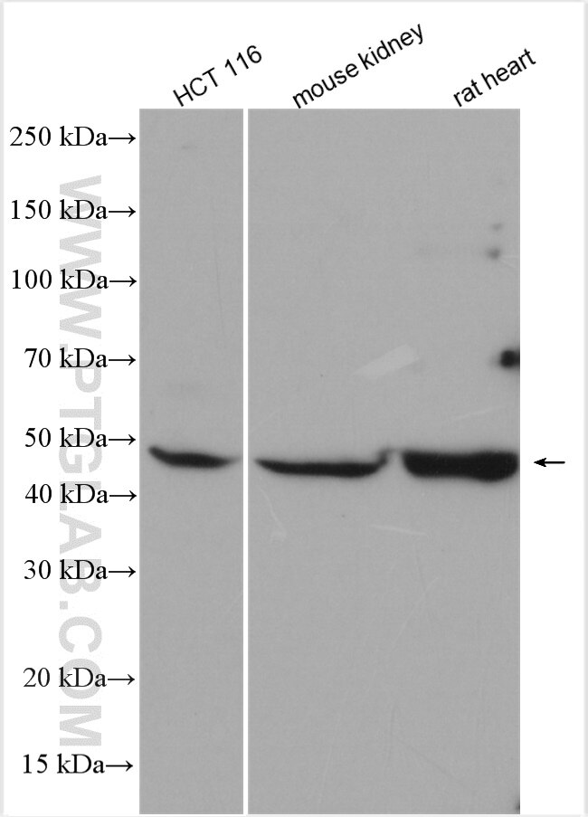 Western Blot (WB) analysis of various lysates using PHD2/EGLN1 Polyclonal antibody (19886-1-AP)