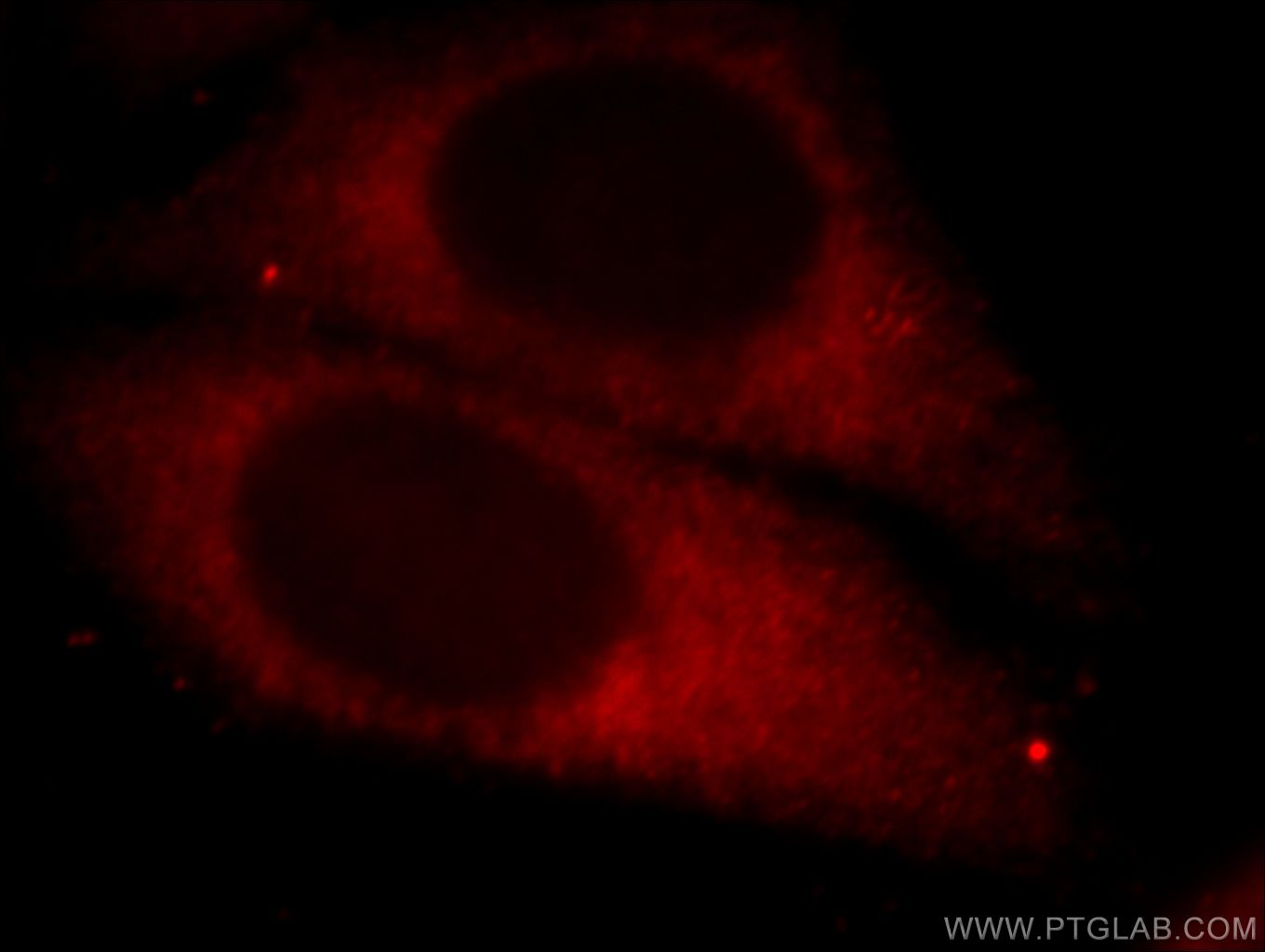 IF Staining of HepG2 using 20368-1-AP