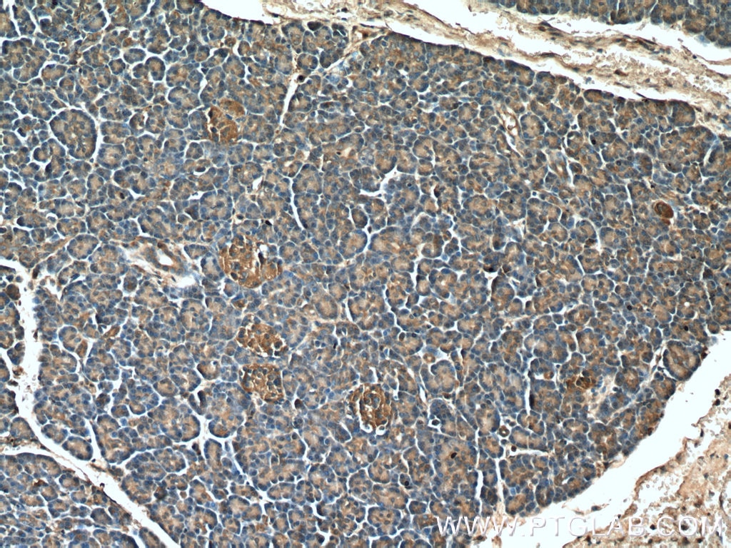 Immunohistochemistry (IHC) staining of human pancreas tissue using PHD2/EGLN1 Polyclonal antibody (20368-1-AP)