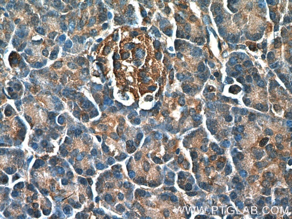 Immunohistochemistry (IHC) staining of human pancreas tissue using PHD2/EGLN1 Polyclonal antibody (20368-1-AP)