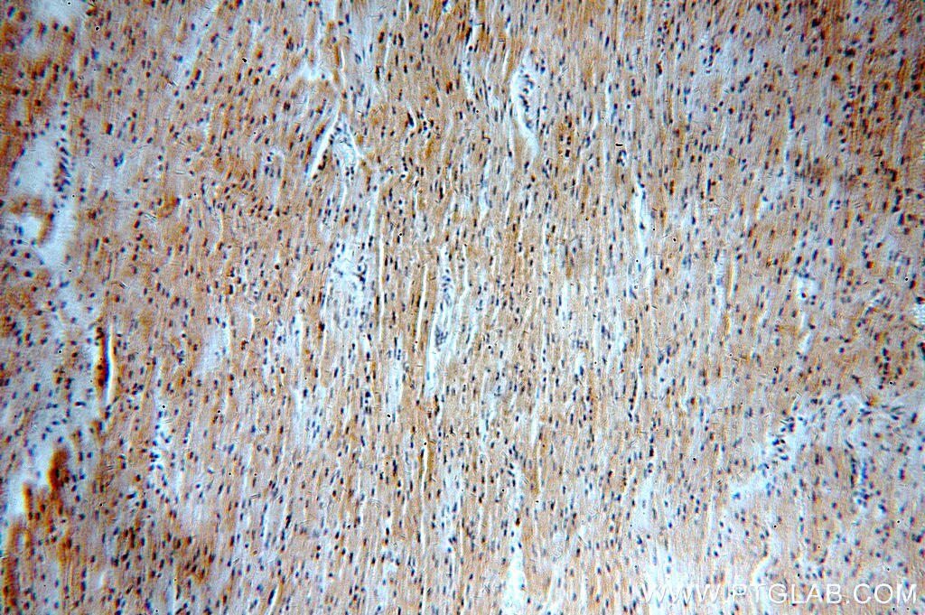 Immunohistochemistry (IHC) staining of human heart tissue using PHD2/EGLN1 Polyclonal antibody (20368-1-AP)