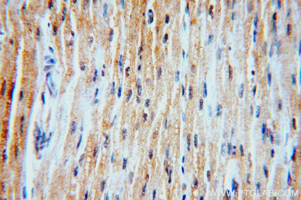 Immunohistochemistry (IHC) staining of human heart tissue using PHD2/EGLN1 Polyclonal antibody (20368-1-AP)