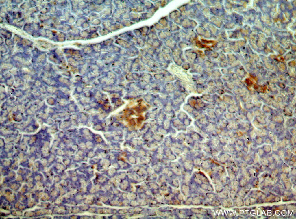 Immunohistochemistry (IHC) staining of human pancreas tissue using PHD2/EGLN1 Polyclonal antibody (20368-1-AP)