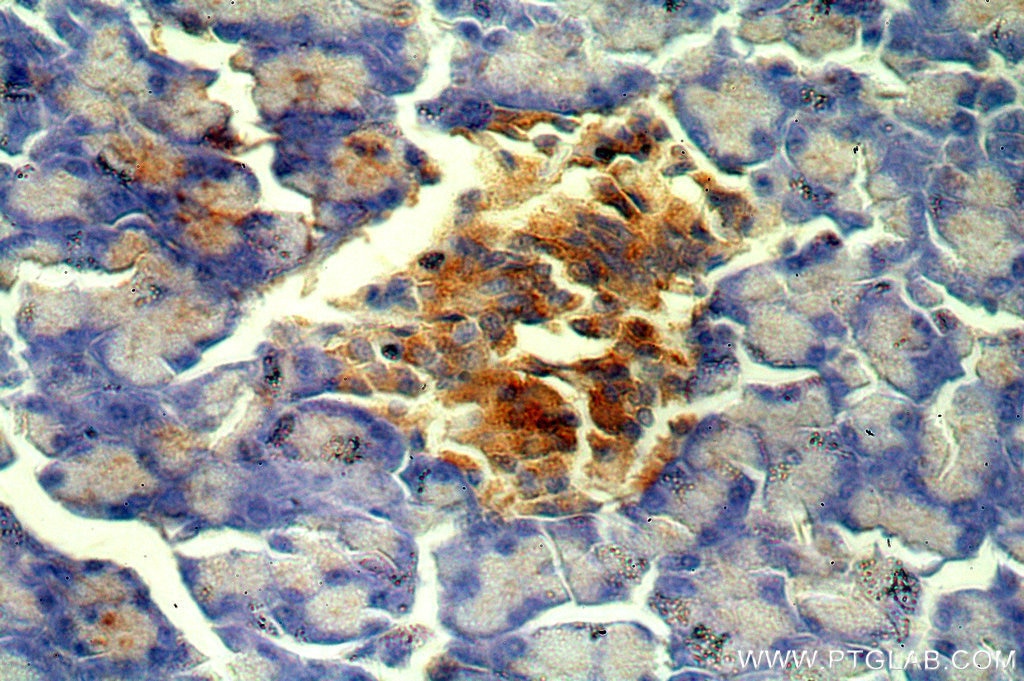 Immunohistochemistry (IHC) staining of human pancreas tissue using PHD2/EGLN1 Polyclonal antibody (20368-1-AP)