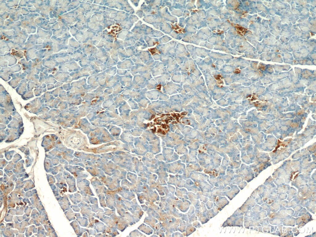 IHC staining of human pancreas using 20368-1-AP