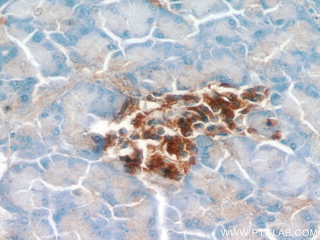 Immunohistochemistry (IHC) staining of human pancreas tissue using PHD2/EGLN1 Polyclonal antibody (20368-1-AP)