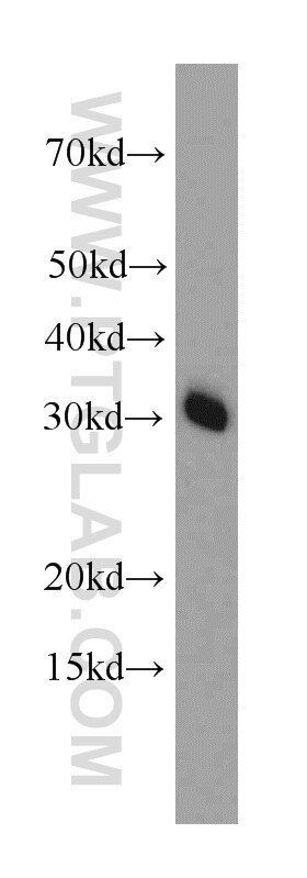 PHD2/EGLN1