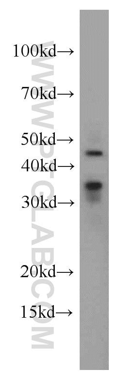 Western Blot (WB) analysis of mouse pancreas tissue using PHD2/EGLN1 Polyclonal antibody (20368-1-AP)