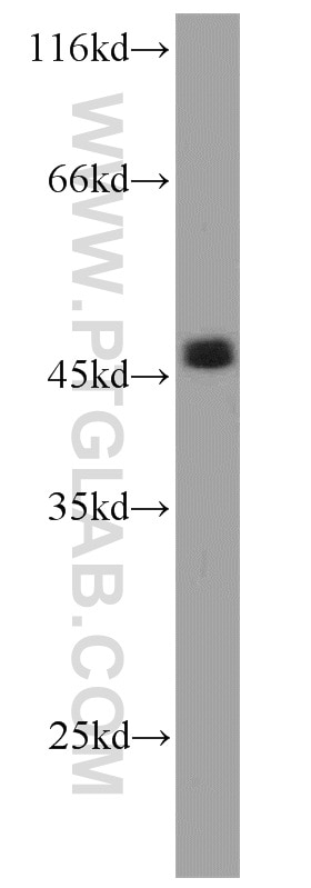 Western Blot (WB) analysis of HEK-293 cells using PHD2/EGLN1 Polyclonal antibody (20368-1-AP)