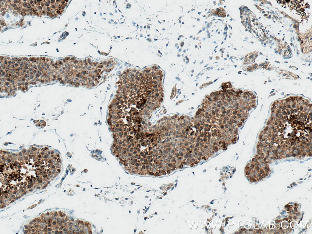 Immunohistochemistry (IHC) staining of human testis tissue using PHD2/EGLN1 Monoclonal antibody (66589-1-Ig)