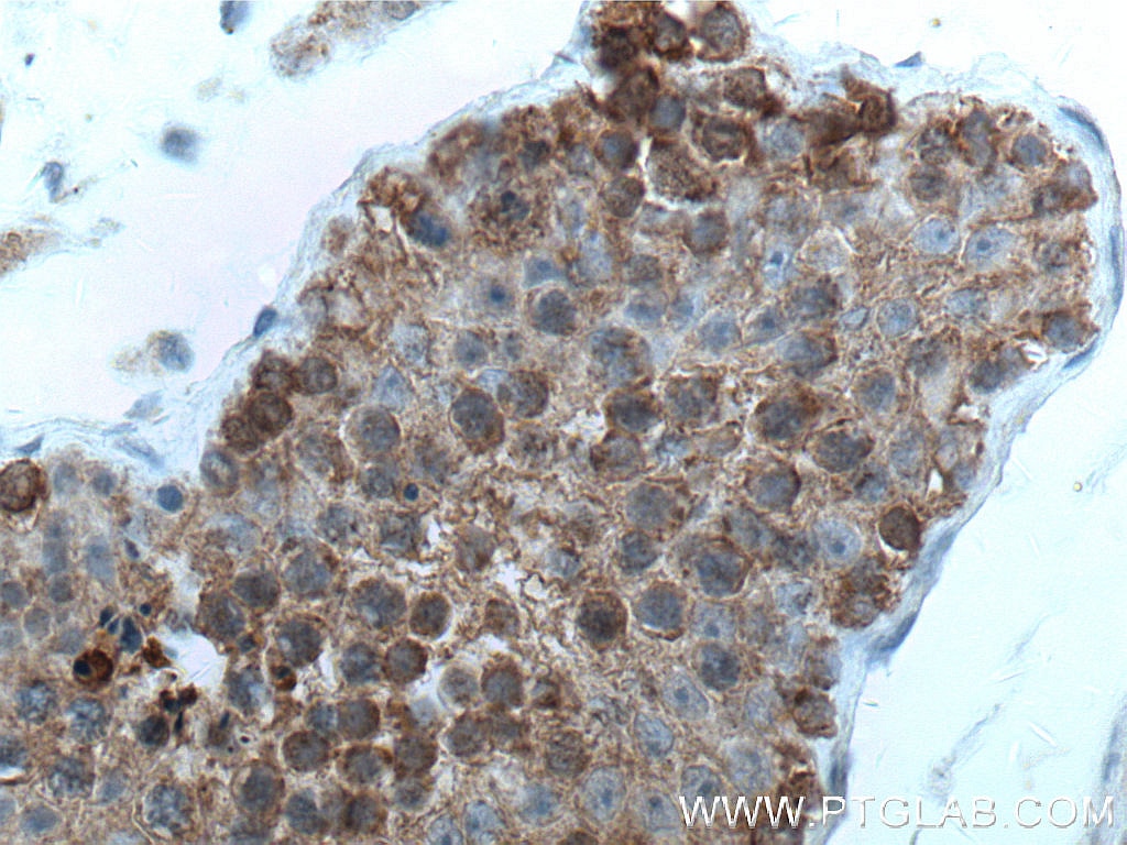 Immunohistochemistry (IHC) staining of human testis tissue using PHD2/EGLN1 Monoclonal antibody (66589-1-Ig)