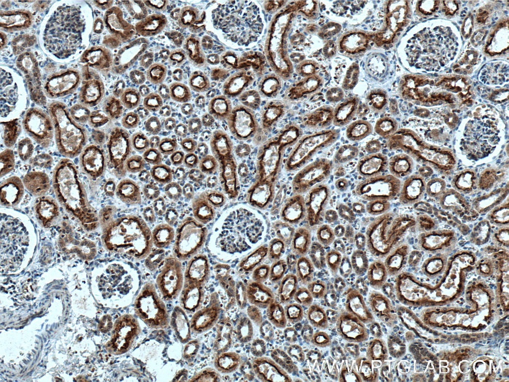 Immunohistochemistry (IHC) staining of human kidney tissue using PHD2/EGLN1 Monoclonal antibody (66589-1-Ig)