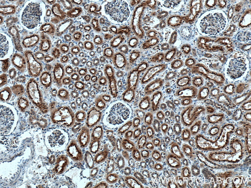 IHC staining of human kidney using 66589-1-Ig