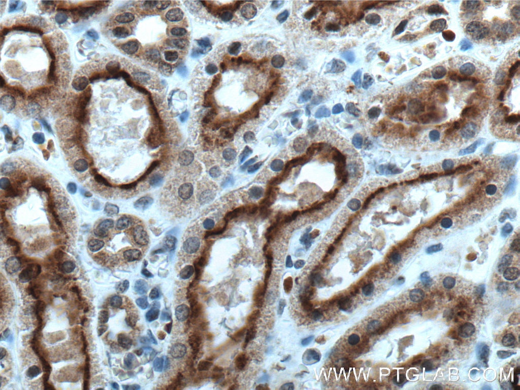 Immunohistochemistry (IHC) staining of human kidney tissue using PHD2/EGLN1 Monoclonal antibody (66589-1-Ig)