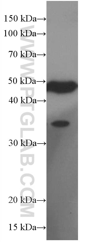 Western Blot (WB) analysis of SH-SY5Y cells using PHD2/EGLN1 Monoclonal antibody (66589-1-Ig)