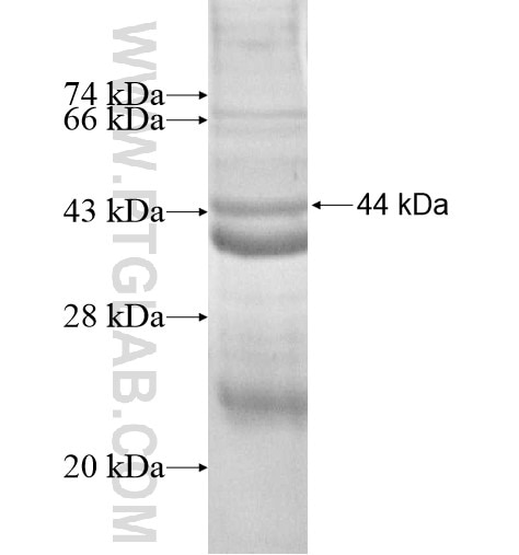 EGLN1 fusion protein Ag13706 SDS-PAGE