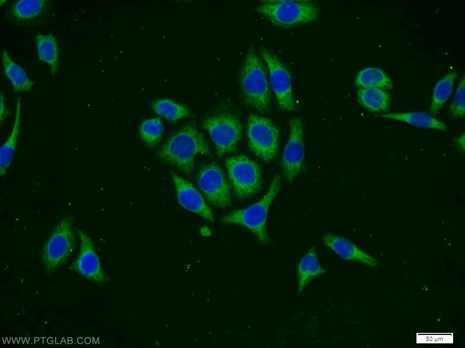Immunofluorescence (IF) / fluorescent staining of PC-3 cells using PHD1 Polyclonal antibody (12984-1-AP)