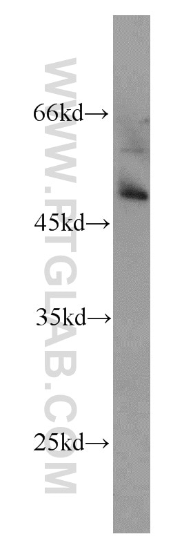 Western Blot (WB) analysis of mouse heart tissue using PHD1 Polyclonal antibody (12984-1-AP)