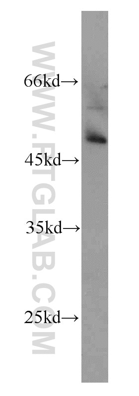 WB analysis of mouse heart using 12984-1-AP