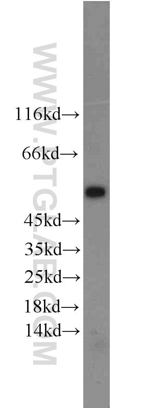 Western Blot (WB) analysis of mouse testis tissue using PHD1 Polyclonal antibody (12984-1-AP)