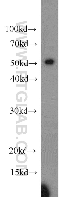 WB analysis of HeLa using 12984-1-AP